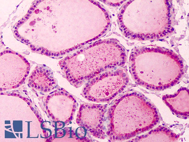 IHC-plus™ PAK2 Antibody