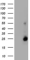 Monoclonal Mouse anti-Human UBE2E3 Antibody (clone OTI1D10, WB)