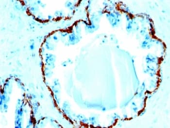 Monoclonal Mouse anti-Human Basic Cytokeratin Antibody (clone SPM591, IHC, IF, WB)