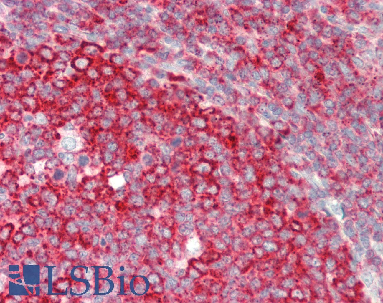 IHC-plus™ Polyclonal Rabbit anti-Human RPL7A / Ribosomal Protein L7a Antibody (aa215-C-term, IHC, WB)