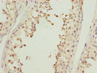 ACTL7B Antibody