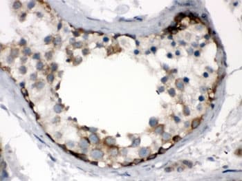 Polyclonal Rabbit anti-Human TCP1 Antibody (IHC, WB)