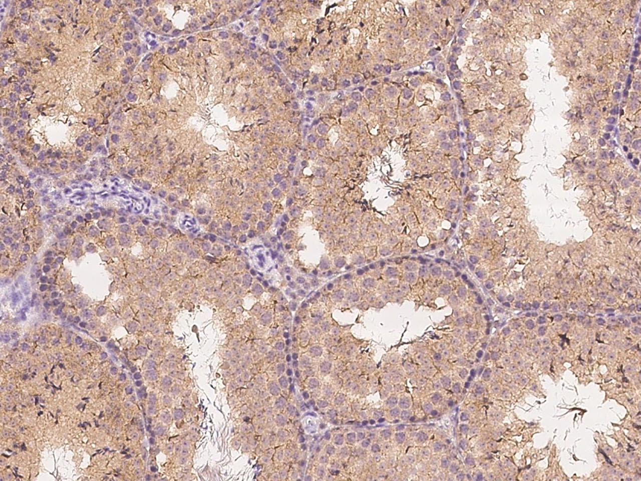 Polyclonal Rabbit anti-Mouse IL7R / CD127 Antibody (Preservative Free, IHC)