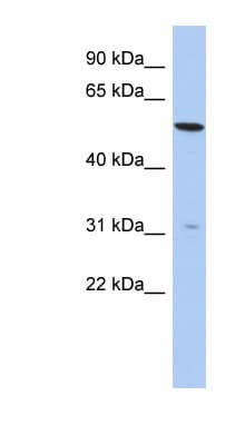 TMEM161B Antibody (aa35-84)