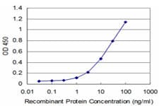 IHC-plus™ UBTF / UBF Antibody (clone 1A2)