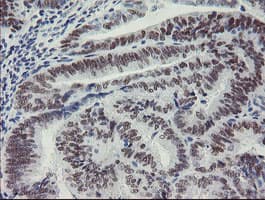 MEIS3 Antibody (aa1-261, clone OTI1B2)