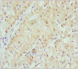 CRYGS Antibody