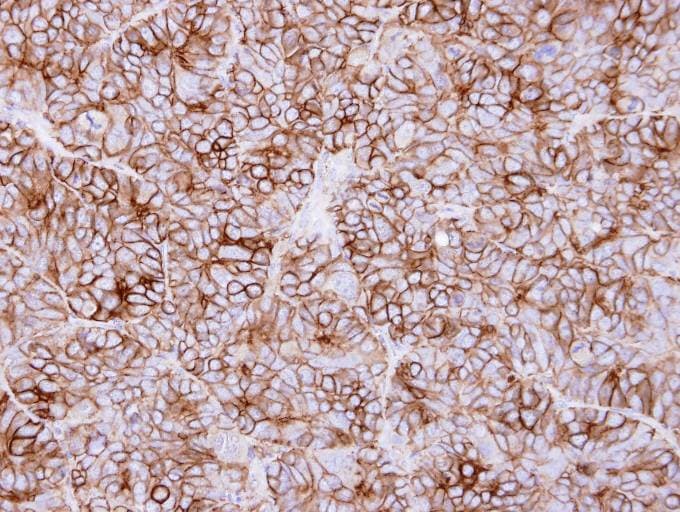 IHC-plus™ Polyclonal Rabbit anti-Human KIDINS220 / ARMS Antibody (aa1706-1771, IHC, WB)
