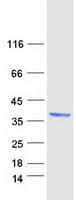 Human DHRS3 / SDR1 Protein (Recombinant Myc-DDK (Flag))