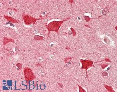 IHC-plus™ Polyclonal Rabbit anti-Human ZNF423 / OAZ Antibody (aa250-300, IHC, WB)