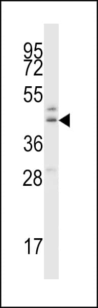 Polyclonal Rabbit anti-Human B4GAT1 / B3GNT1 Antibody (aa366-394, IHC, WB)