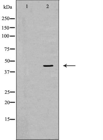 CTSE / Cathepsin E Antibody