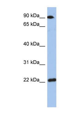 TMED10 / TMP21 Antibody (aa143-192)
