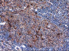 SQSTM1 Antibody (clone OTI4G9)