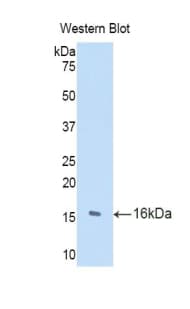 TRIP / LRRFIP1 Antibody (aa615-735, PE)
