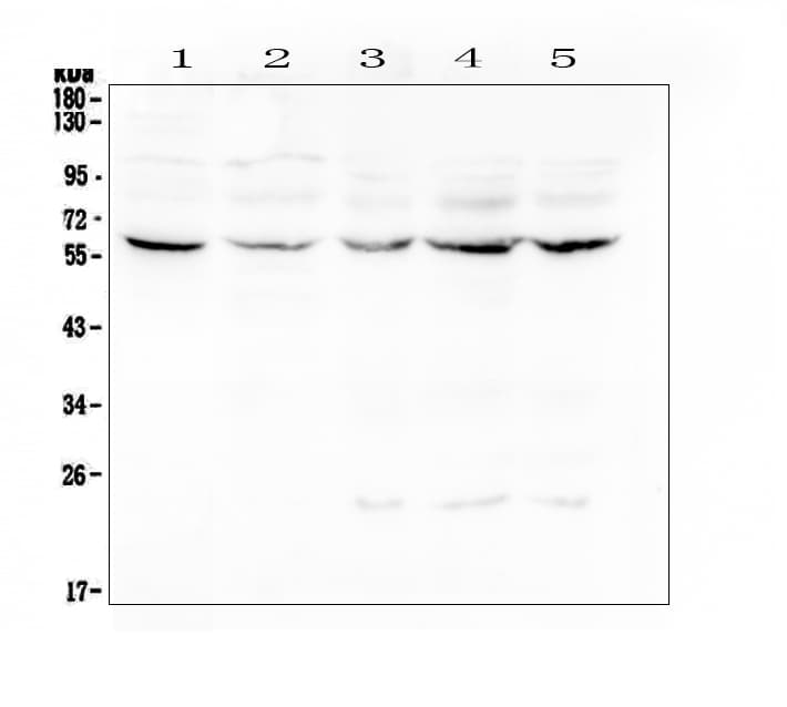 Polyclonal Rabbit anti-Human Lumican Antibody (IHC, WB)