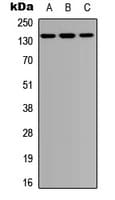 Polyclonal Rabbit anti-Human PTPN21 / PTPD1 Antibody (N-Terminus, WB)