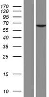 FSCN2 / Retinal Fascin Protein (Over-Expression Lysate Myc-DDK (Flag))