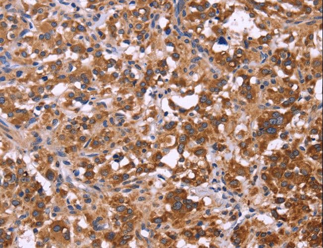 FBXW7 / FBW7 Antibody