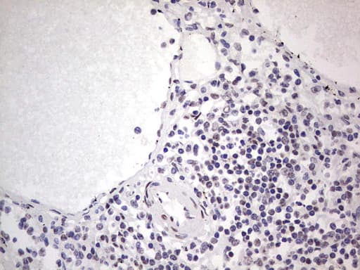 SAE1 Antibody (clone OTI3C3)