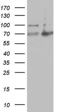 ARAF / ARAF1 / A-RAF Antibody (aa145-365, clone OTI2F5)