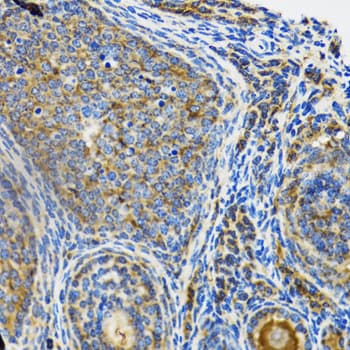 Polyclonal Rabbit anti-Human IRAK4 / IRAK-4 Antibody (IHC, WB)