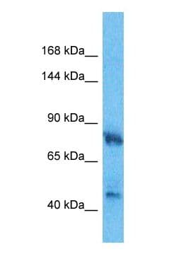 HMG-CoA Reductase / HMGCR Antibody (C-Terminus)