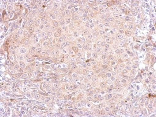 KLK3 / PSA Antibody (aa194-261)