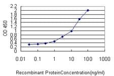 IHC-plus™ Monoclonal Mouse anti-Human RICTOR Antibody (clone 1F3, IHC, WB)