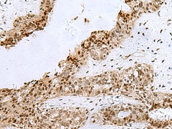 H2AFJ Antibody