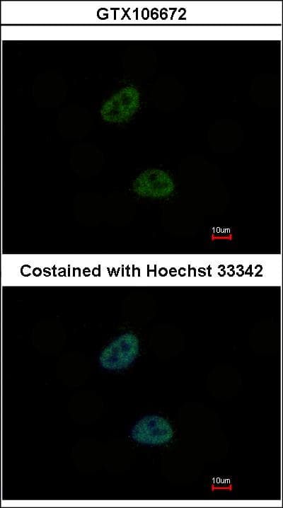 C20orf11 / TWA1 Antibody (aa1-208)