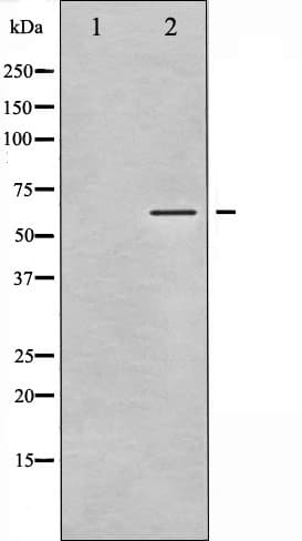 Polyclonal Rabbit anti-Human CAMK2A / CaMKII Alpha Antibody (phospho-Thr305, IHC, IF, WB)