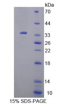 Mouse UP / UPP1 Protein (Recombinant His-T7)