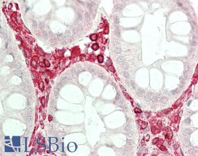 IHC-plus™ Polyclonal Rabbit anti-Human RRAGC / RAGC Antibody (aa266-315, IHC, WB)