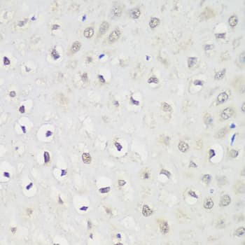 KPNA3 / Importin Alpha 4 Antibody