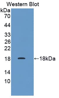 PFDN1 Antibody (aa1-122)