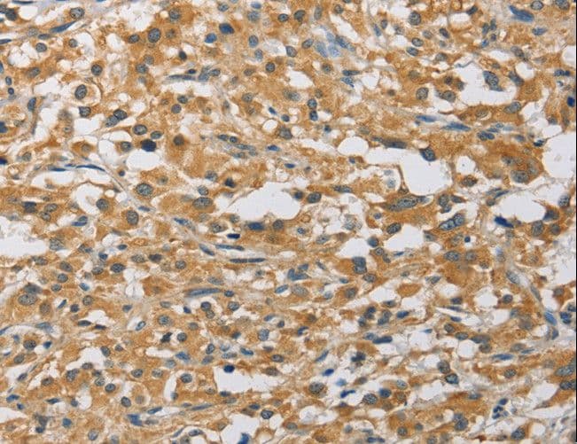 Polyclonal Rabbit anti-Human MIP / AQP0 / Aquaporin 0 Antibody (IHC)