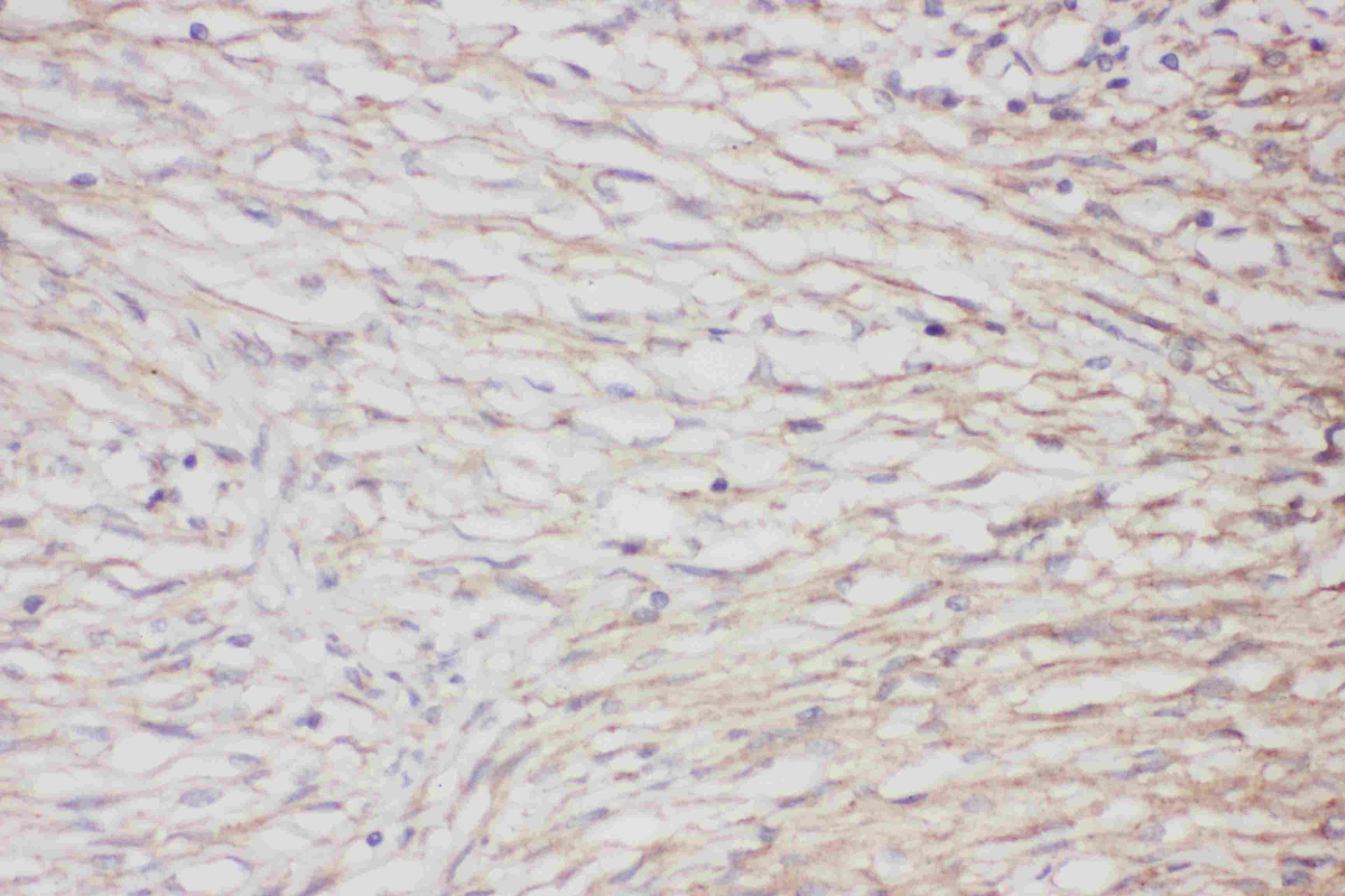 GFAP Antibody (aa93-432)
