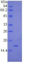 Human MLC3F / MYL1 Protein (Recombinant His)
