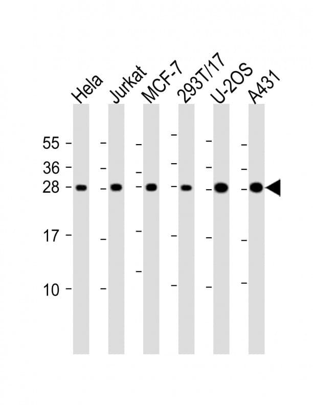 RPL14 / Ribosomal Protein L14 Antibody (aa117-147)