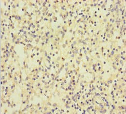 CLEC4D / MCL Antibody (aa39-215)