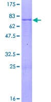 Human NUDT9 Protein (Recombinant GST)