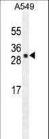 UBTD1 Antibody