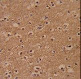 ZBTB2 Antibody (aa335-364)