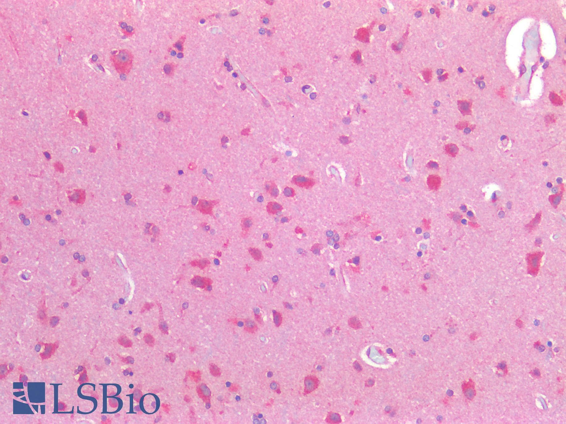 PathPlus™ Osteocalcin Antibody