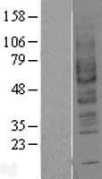 ADORA2B/Adenosine A2B Receptor Protein (Over-Expression Lysate Myc-DDK (Flag))