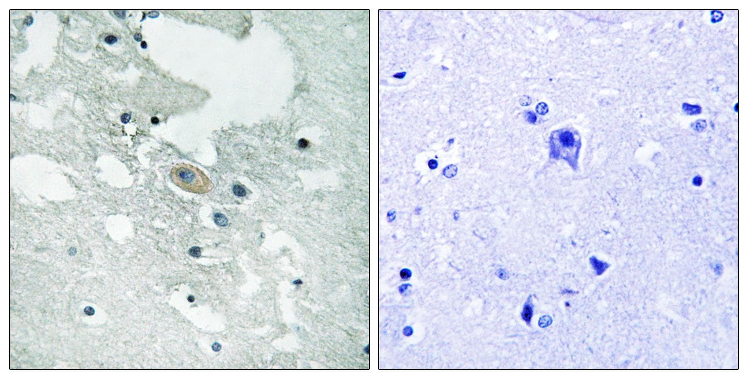 Polyclonal Rabbit anti-Human BLNK Antibody (phospho-Tyr84, IHC, WB)