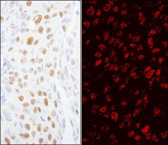 Polyclonal Rabbit anti-Human ZCCHC8 Antibody (aa1-50, IHC, IF)