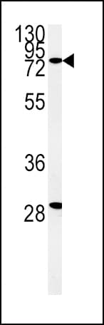 ZFYVE16 Antibody (aa375-404)