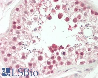 IHC-plus™ AML1 / RUNX1 Antibody (aa150-250)